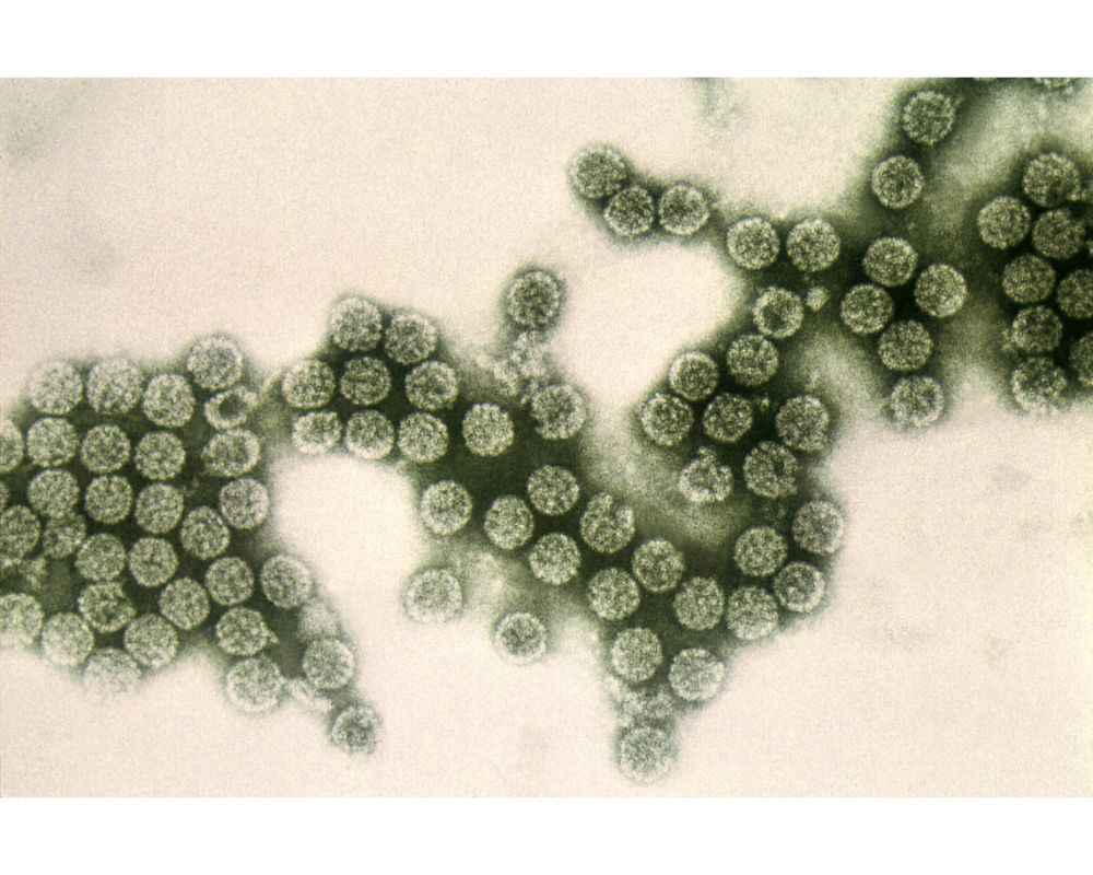 Bacteria de la listeria